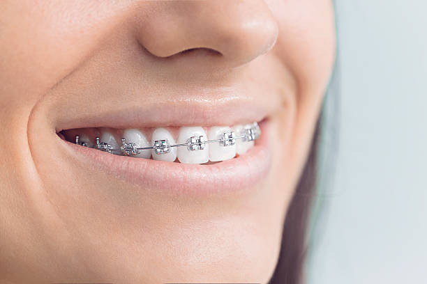 Best Dental Fillings (Composite and Amalgam)  in Queen City, TX